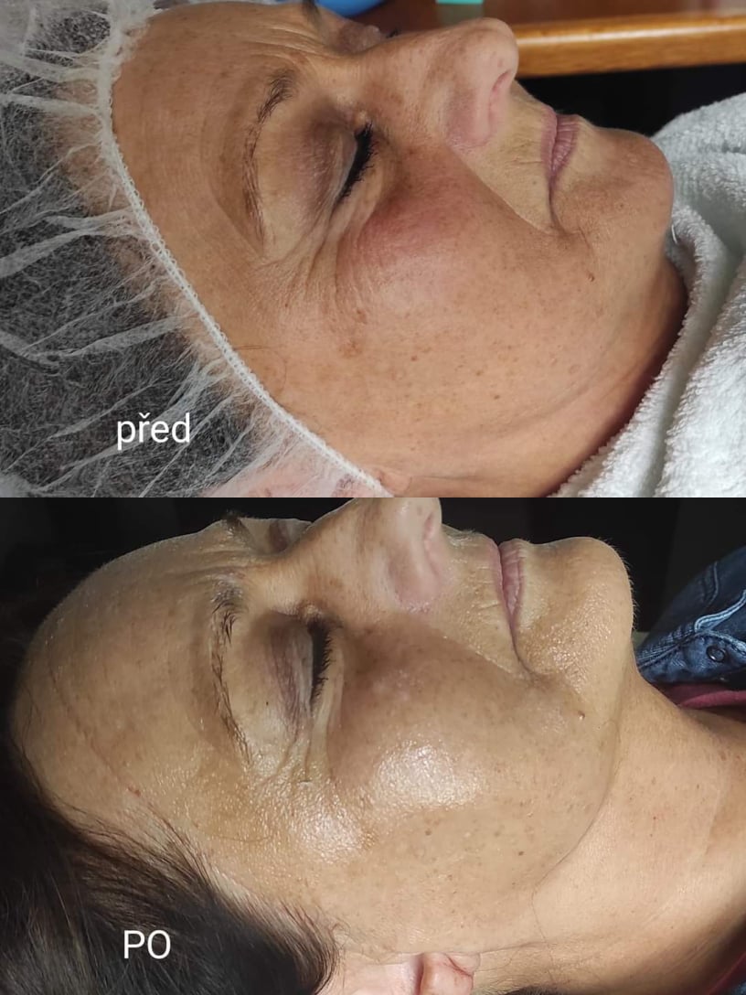 Masáže v Salon Rose